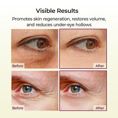 Dr. Melaxin Cemenrete Stick de Vitamina D y Calcio para ojos y rostro